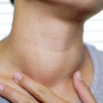 Thyroid enlargement.. causes and complications that should not be ignored!